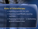 Sclerotherapy : What are the risks associated with sclerotherapy treatments?