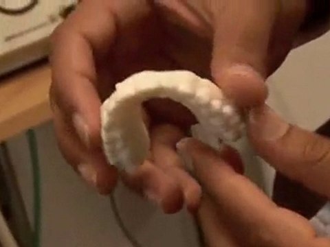 How To Straighten Teeth Without Braces