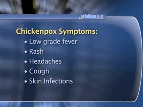 Chickenpox Symptoms : What are the symptoms of chickenpox?