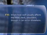 Infant Heat Rash : How can I tell if my infant has heat rash?