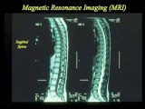 MRI : What is 'MRI'?