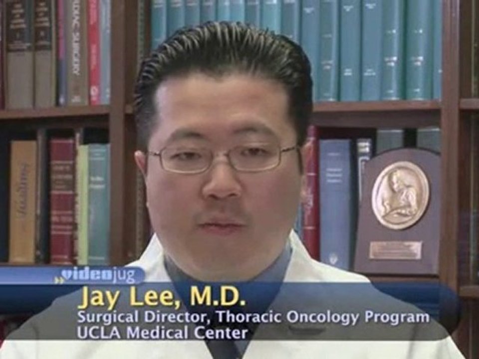 Treatment Of Lung Cancer : What are the treatment options for lung cancer?