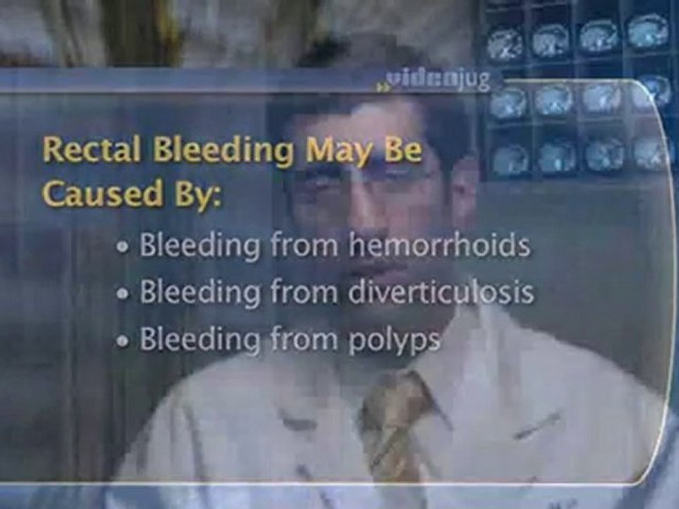 Rectal Bleeding What are the causes of rectal bleeding? video