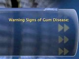 Gum Disease, Gingivitis And Periodontitis : What are the warning signs of gum disease?
