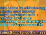 lupus of the scalp - skin lupus treatment - lupus cure and r