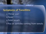 Tonsils And Adenoids : What are the symptoms of tonsillitis?
