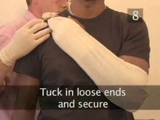 How To Make An Elevation Sling