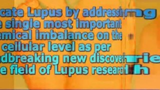 5 Controlled and Precise Steps to Eradicate Lupus by Julia L