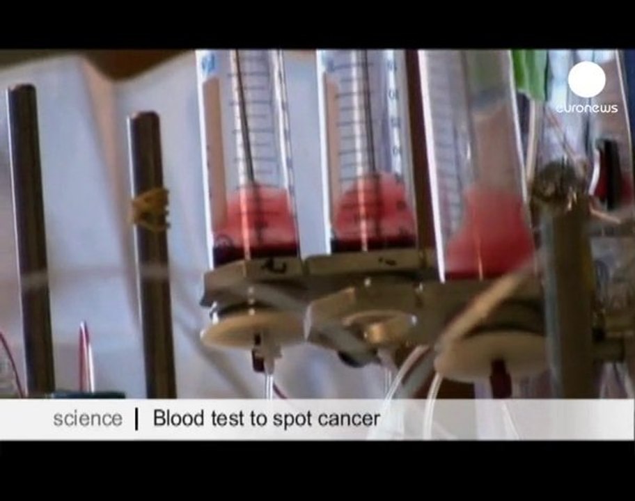 Test antitumorale del sangue