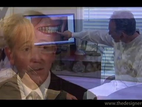 Porcelain Veneers, Crowns and Bridges in Troy & Detroit, MI