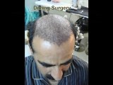 Hair Transplant in Pakistan,Hair Transplant in Lahore,Hair L