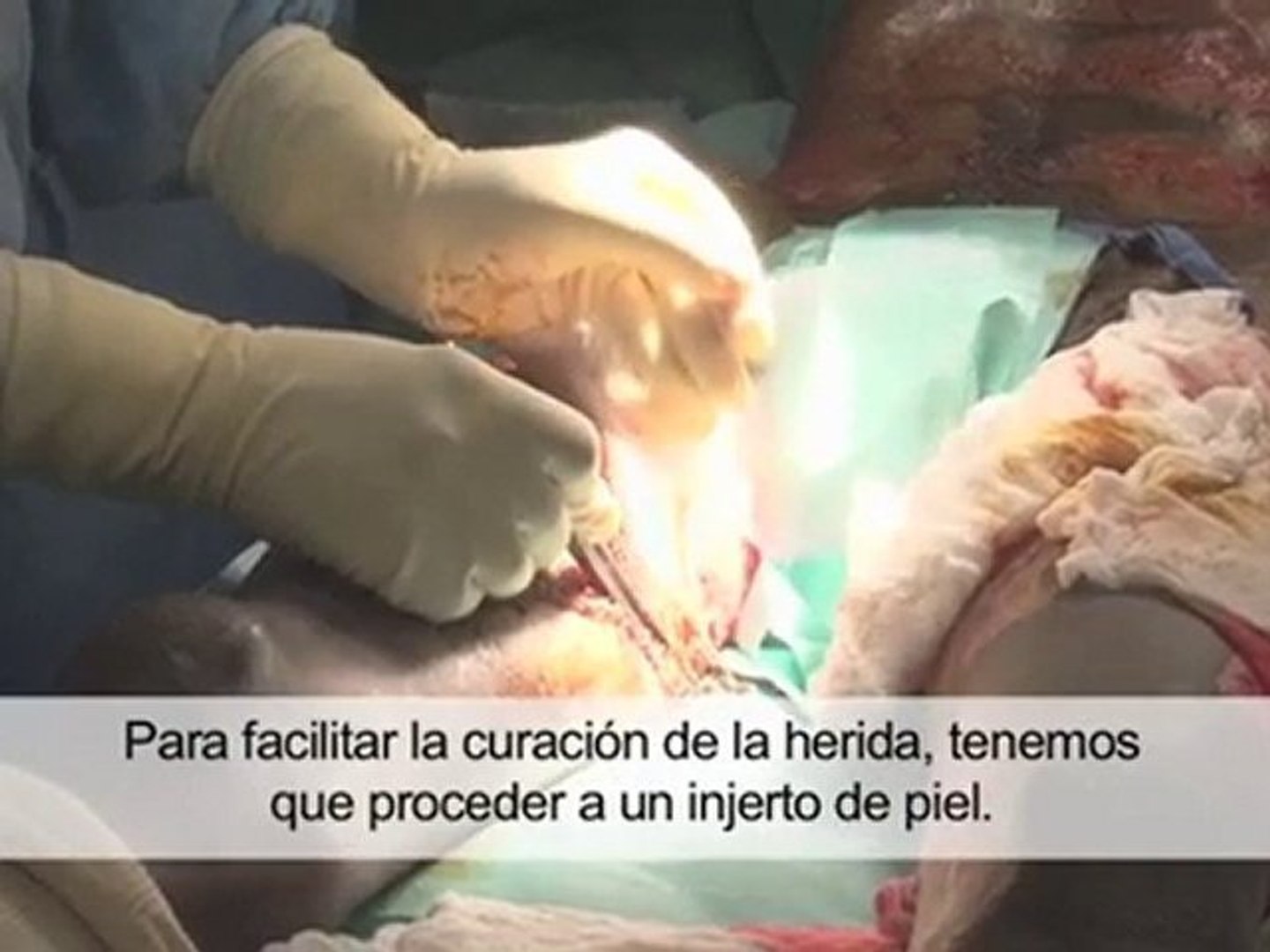 Haití: quemados