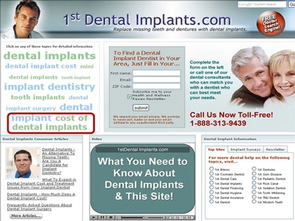 Searching for a Dental Implants Dentist for affordable dent