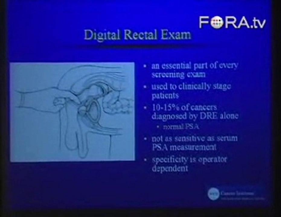 Urologist William Huang: How to Prevent Prostate Cancer