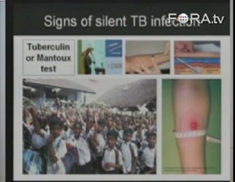 Christopher Dye on Disease Persistence Through History