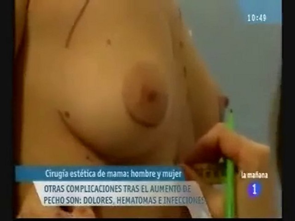 Aumento de pecho información