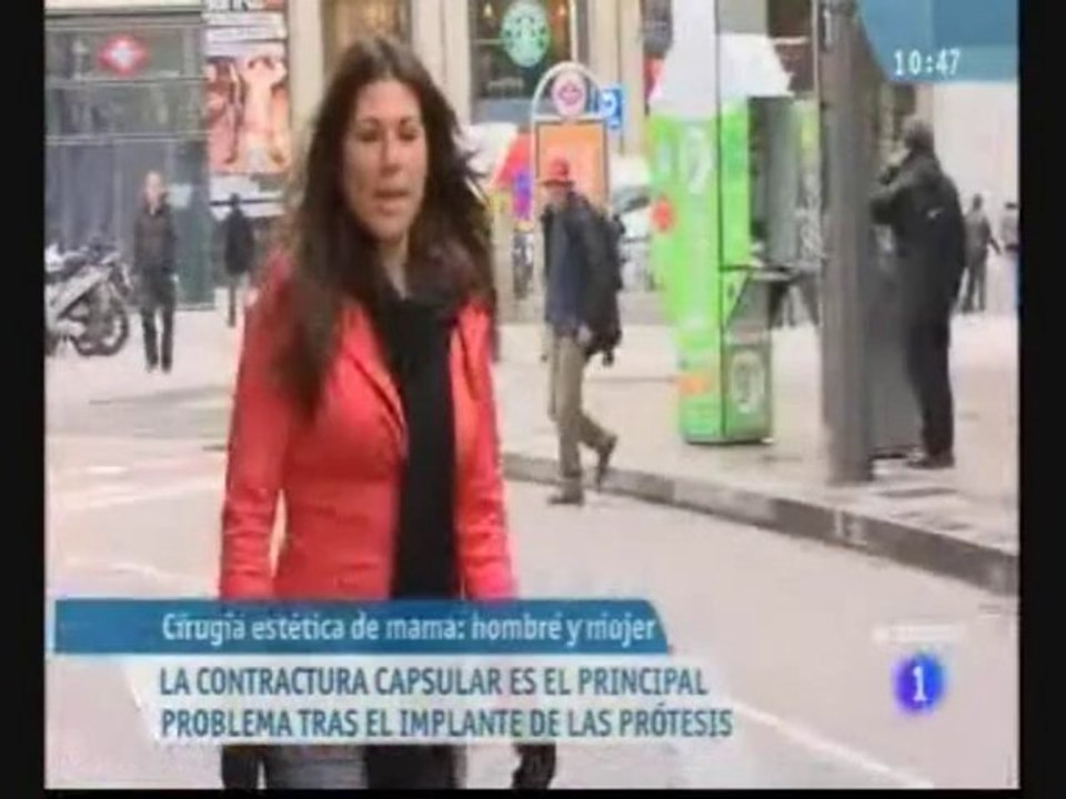 La mamoplastia o aumento de pecho
