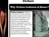 Cirrhosis treatment in Mexico  affordable Cost