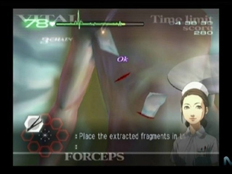 Trauma Center: Second Opinion Walkthrough - Episode ...