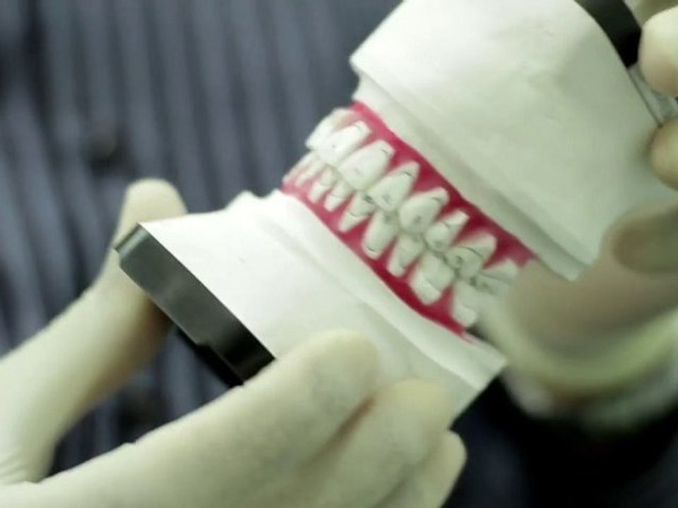 Lingual Brace Certification