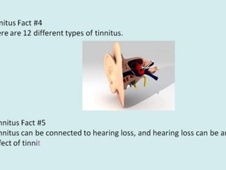 Triumph Tinnitus Today A Step By Step Guide To Turning