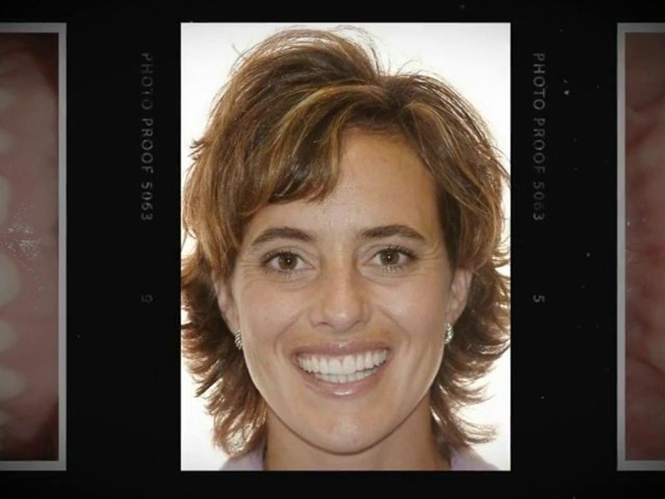 Greeley Invisalign
