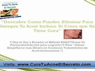 Cura Para el Acne El Secreto (VIDEO)