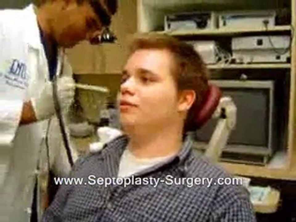 Septoplasty Surgery - Splint removed after septoplasty ...