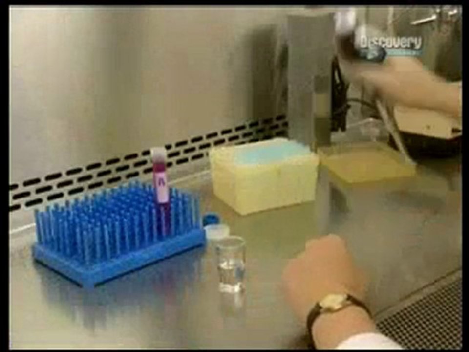 DERİ NAKLİ Nasıl Yapılıyor Dailymotion Video