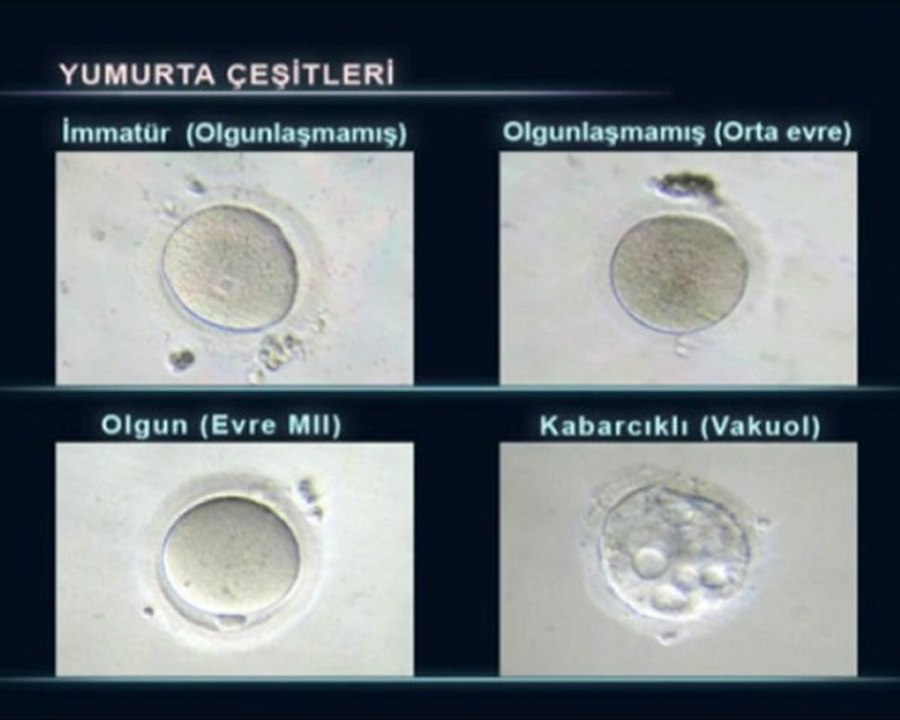 Yumurta