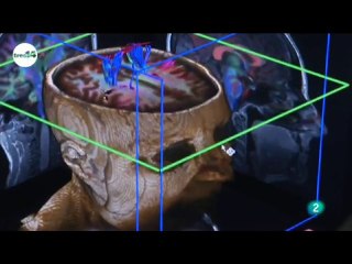 Resonancia magnetica funcional: Ruth de Diego