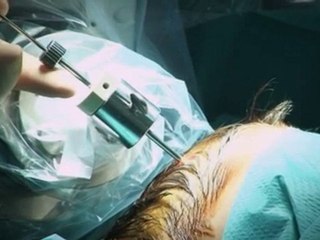 Vidéo de démonstration produit Medtech - Production 2SI PROD