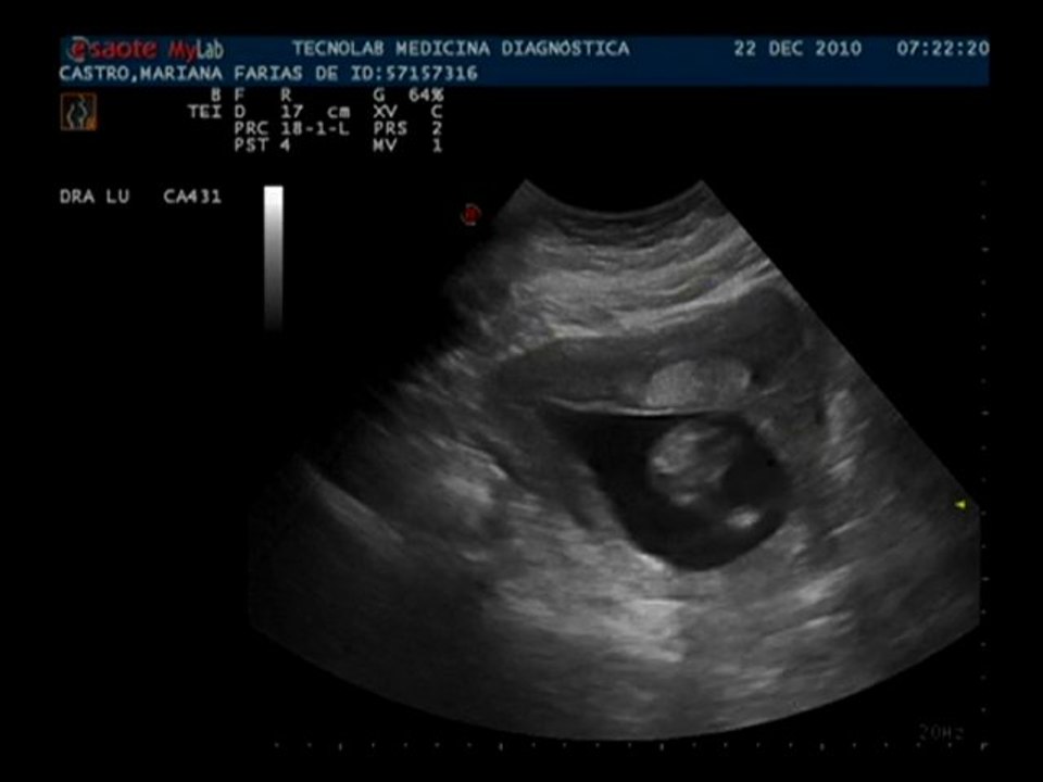 Bebê 16 semanas