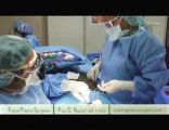 Beverly Hills Housewives surgeon performs facelift surgery under local anesthesia