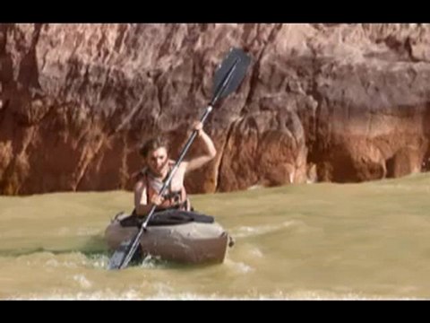 estetik gogus burun estetigi 3st3tik