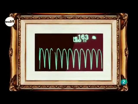 Electroencefalogafia (EEG): Lluis Fuentemilla