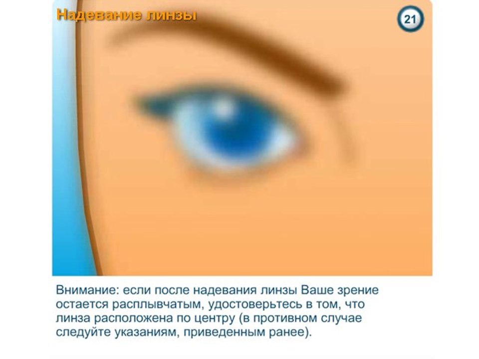 Контактные линзы ACUVUE – инструкция по применению
