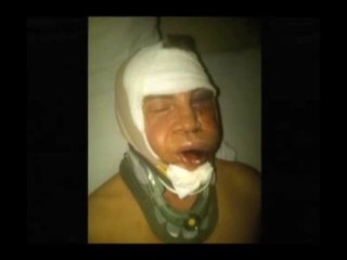 Louisanna Gay Hate Crime