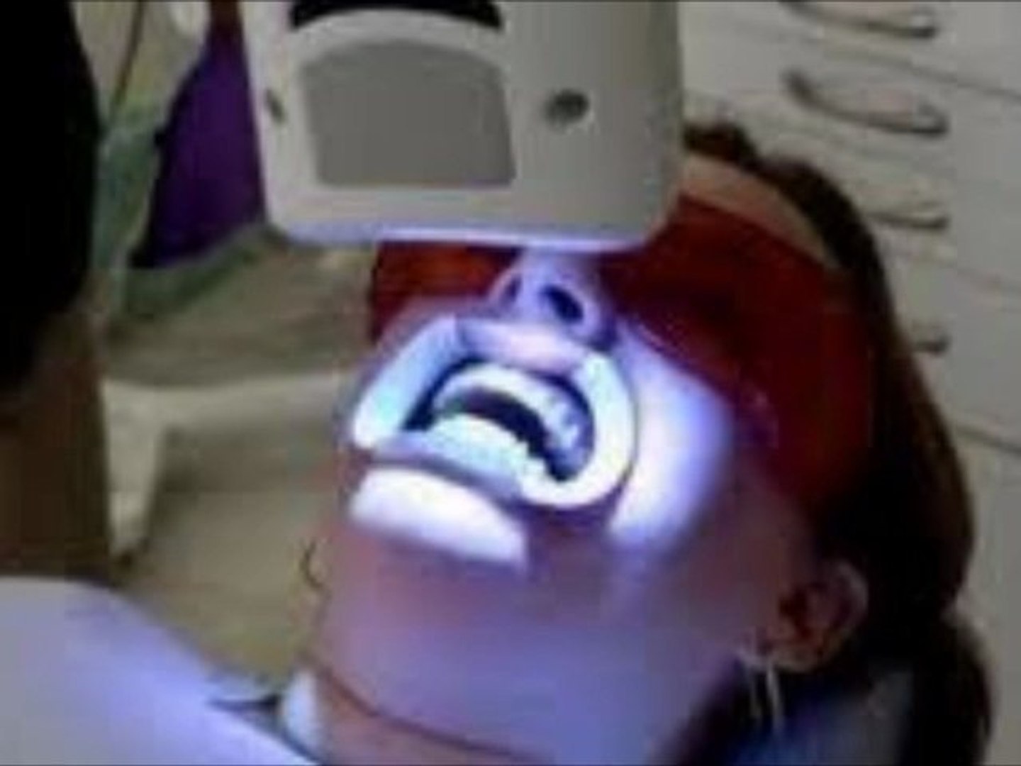 ⁣Celebrity Teeth Whitening Secret at Home