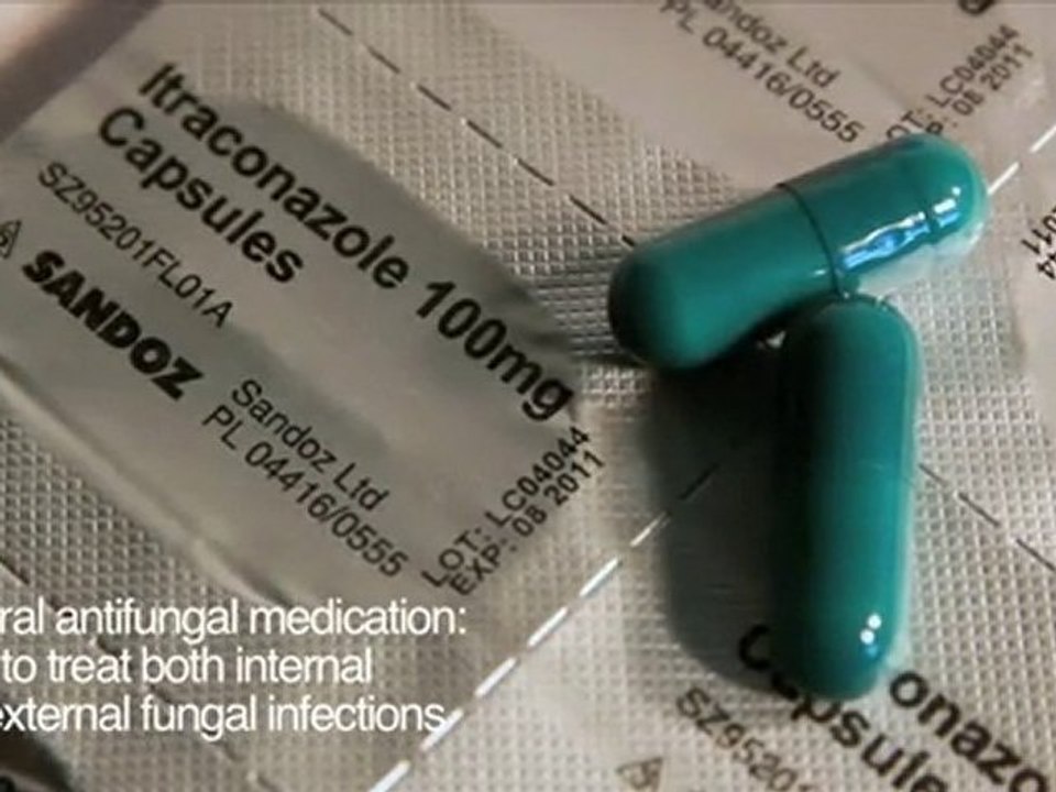 Itraconazole 100 mg Oral Antifungal Medication video Dailymotion
