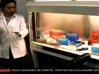 Especialistas nicaragüenses crean método para detectar la leptospirosis