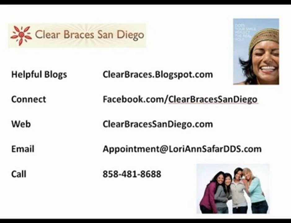 Clear Braces vs Metal Braces for Staight Teeth San Diego