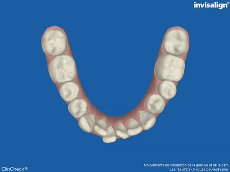 vue occlusale mandibulaire