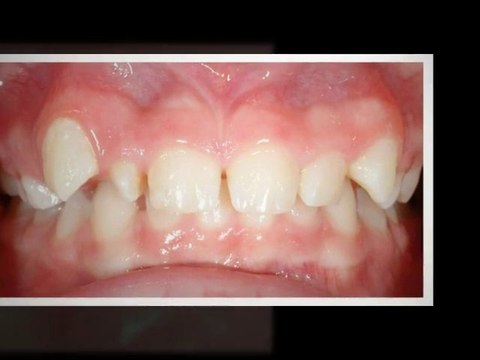 Parker Orthodontist: Imagine Your New Smile!