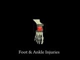 Foot Pain and Ankle Sprains -  Family Foot and Leg Center / Naples Podiatrist