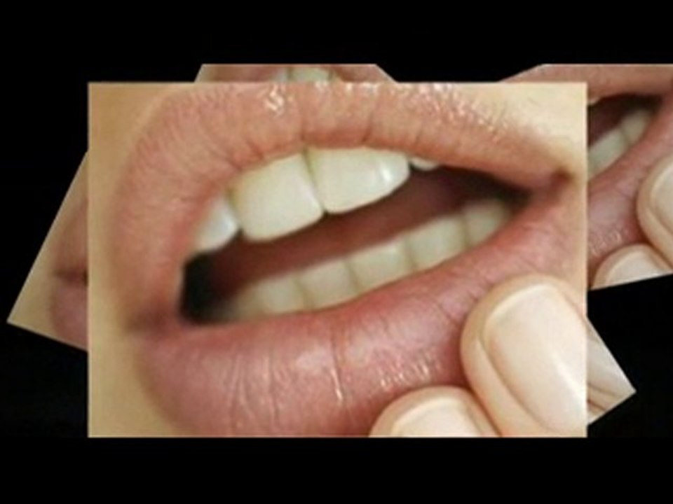 How to Get Rid of Cold Sores Fast