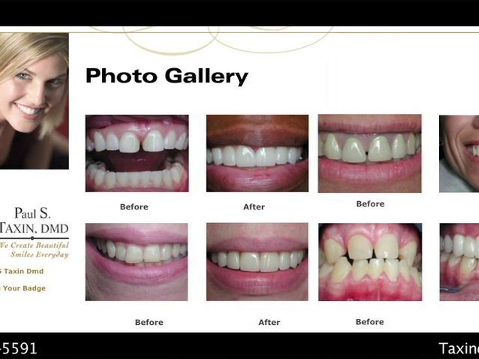 Paul S. Taxin, DMD – Cosmetic and Restorative Dentist in Hop