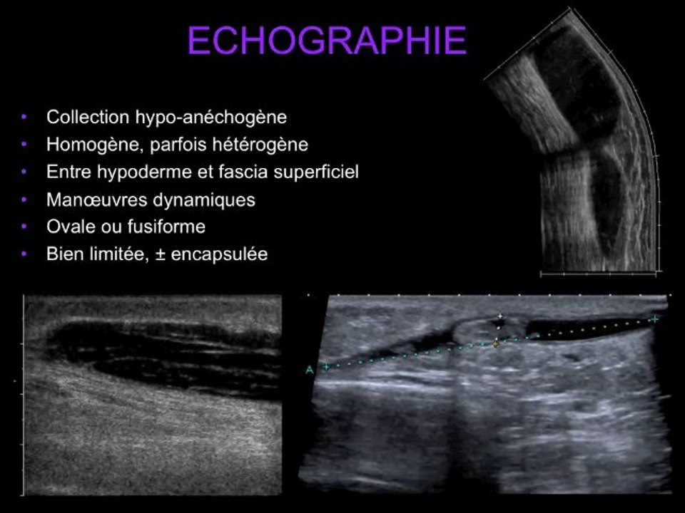Une glissade à moto