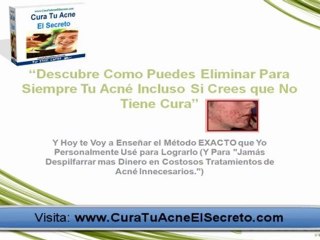 ¿Como Eliminar el Acne? (Reporte GRATIS)