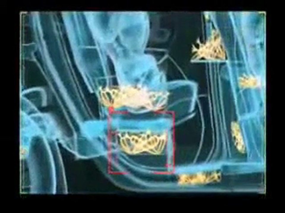 Lapins Crétins - Renault Scenic Test !! L'intégrale !!
